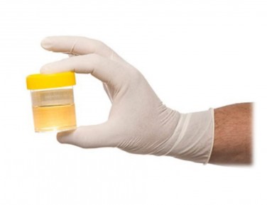Test urine